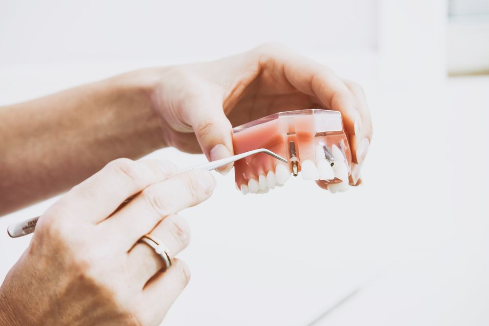 Hva kan din tannlege hjelpe med?